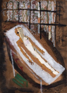 Akupunktura